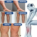 Parches Para Varices