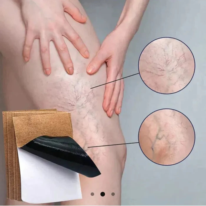 Parches Para Varices